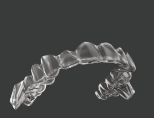 インビザラインを知る