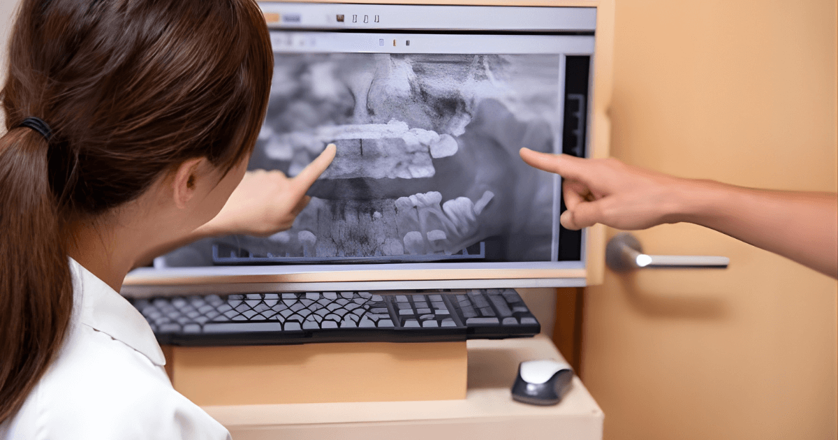 審美歯科　できること