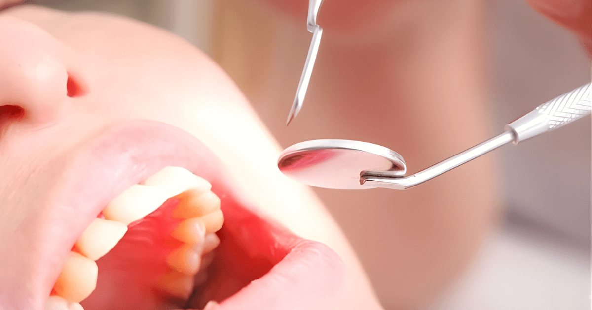 メリット　デメリット