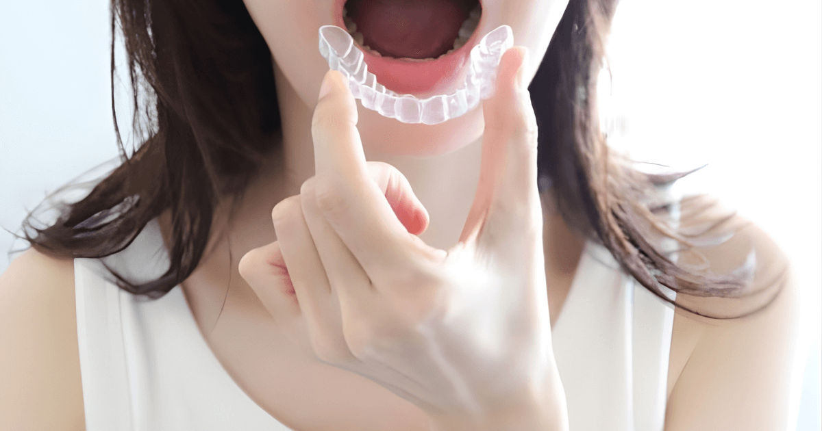 審美歯科　主な治療法