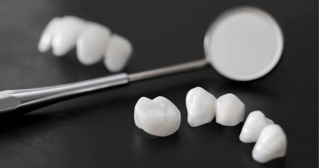 セラミックの歯