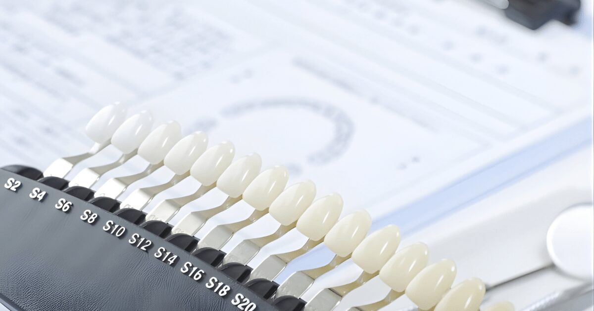 前歯　きれいにする　治療法