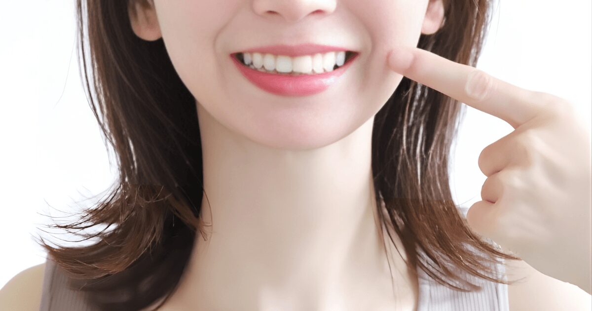 審美歯科　前歯　きれいにする