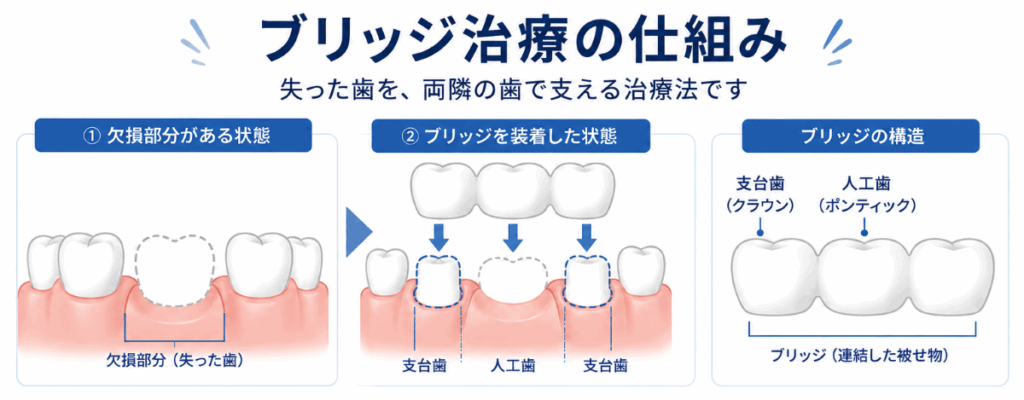 ブリッジの仕組み